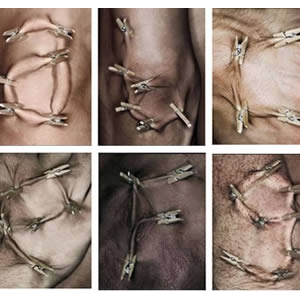 Typeface In Skin